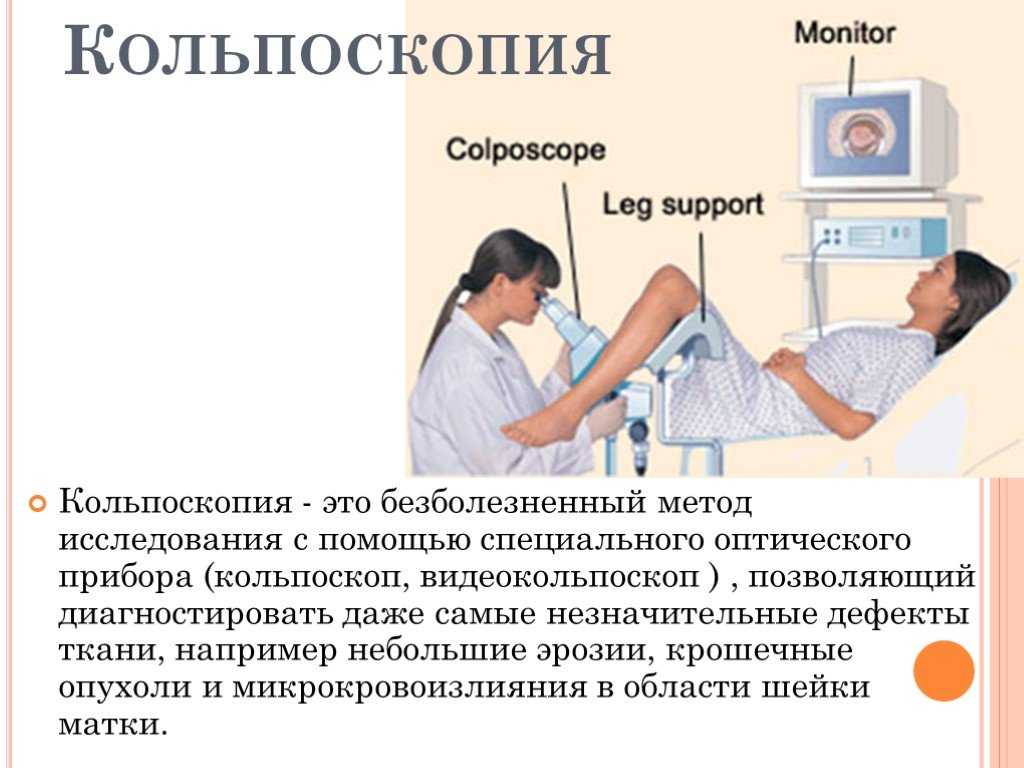 Кольпоскопия шейки что за процедура