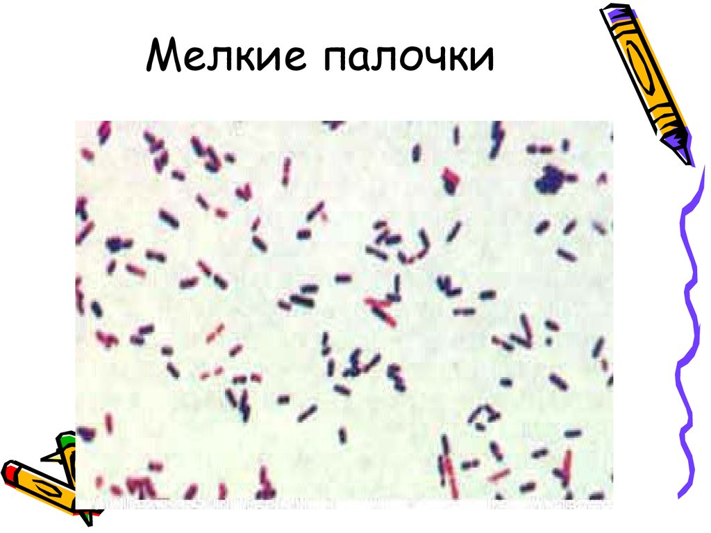 Палочки в мазке. Грамположительные палочки и кокки. Флора палочки мелкие палочки кокки. Флора мазка палочки и кокки. Микрофлора мелкие палочки кокки.