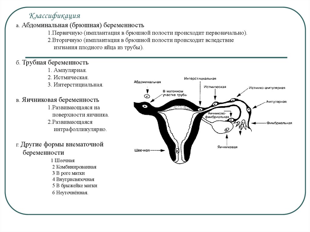 Без маточное беременность. Трубная беременность классификация. Внематочная Трубная ампулярная беременность. Внематочная беременность схема. Истмическая внематочная беременность.