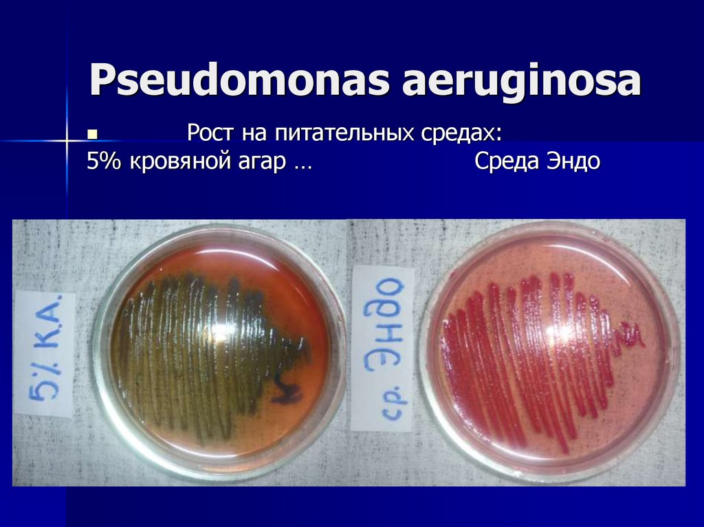 Pseudomonas aeruginosa 10. Псевдомонас аэругиноза на среде Эндо. Синегнойная палочка микробиология на кровяном агаре. Питательная среда Эндо микробиология. Синегнойная палочка на среде Эндо.