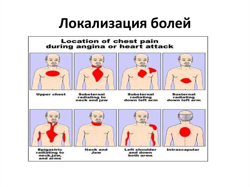 Заболевания локализация боли. Локализация боли в груди. Локализация боли в грудной клетке. Локализация сердечных болей. Локализация боли в сердце.