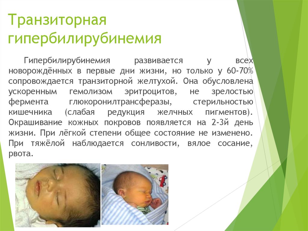 Желтуха новорожденных отзывы. Физиологическая желтуха новорожденных клинические проявления. Неонатальная желтуха физиологическая. Транзиторная желтуха новорожденных обусловлена. Гипербилирубинемии новорожденных.