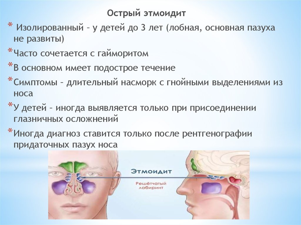 Фронтит симптомы. Острый этмоидит этиология. Острый двухсторонний этмоидит. Этмоидит (воспаление решетчатой пазухи). Этмоидальный синусит симптомы.