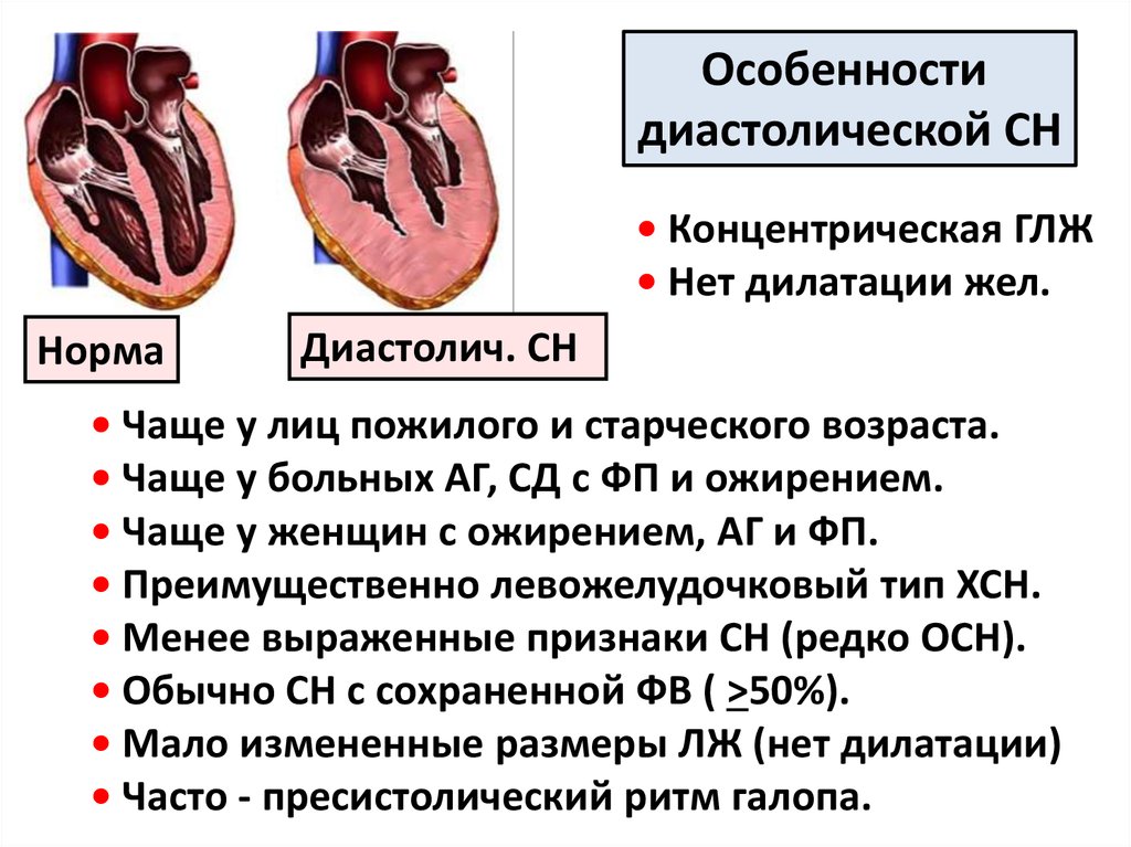 Причины гипертрофии левого желудочка. Гипертрофия миокарда левого желудочка сердца что это такое. Концентрическая гипертрофия левого желудочка. Гипертрофия левого желудочка причины. Гипертрофия миокарда лж.