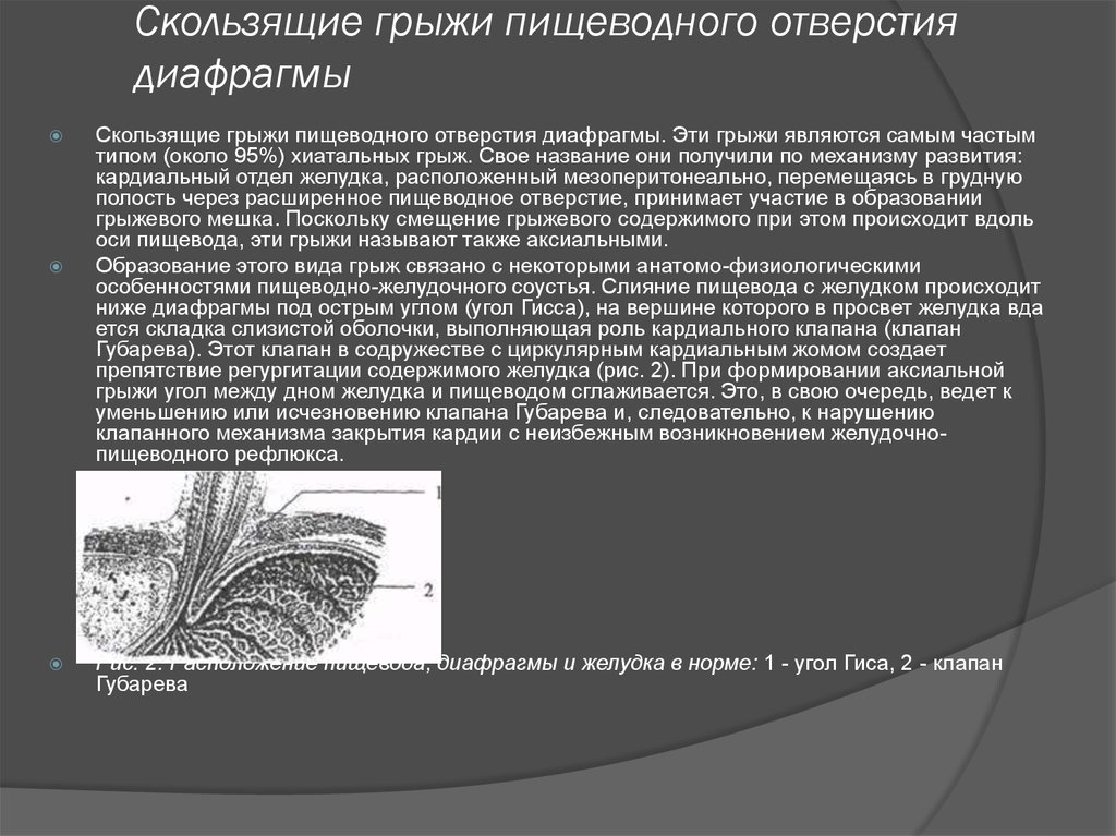 Грыжа пищеводного отверстия диафрагмы симптомы