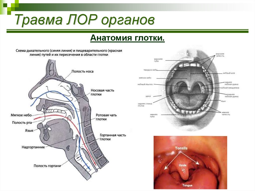 Полость случай. Анатомия ухо горло нос строение. Строение ЛОР органов схема. Строение ЛОР органов гортань. Ухо анатомия строение ЛОР.