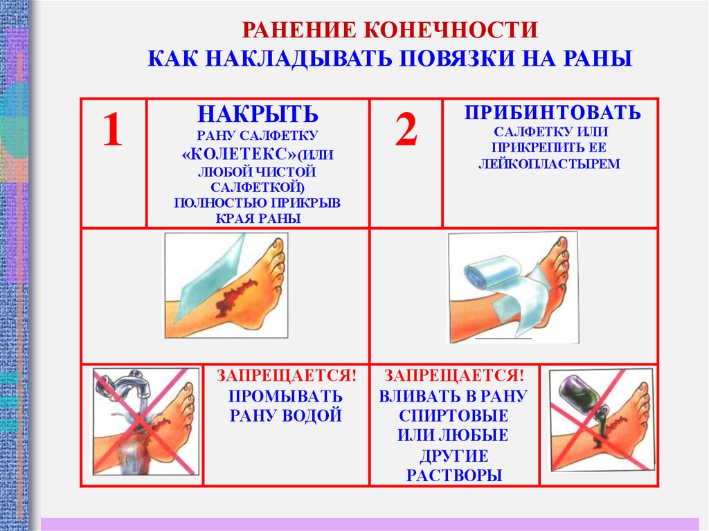 Как открыть рану. Порядок наложения повязки при ранениях конечностей. Правила наложения повязок при ранении конечностей. Наложение повязки на раны при ранении конечностей. При ранении конечностей необходимо.