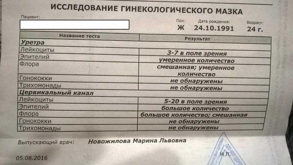 Мазок что показывает у женщин. Исследование гинекологического мазка. Анализы гинеколога мазок. Исследование у гинеколога мазок на. Общий анализ гинеколога.