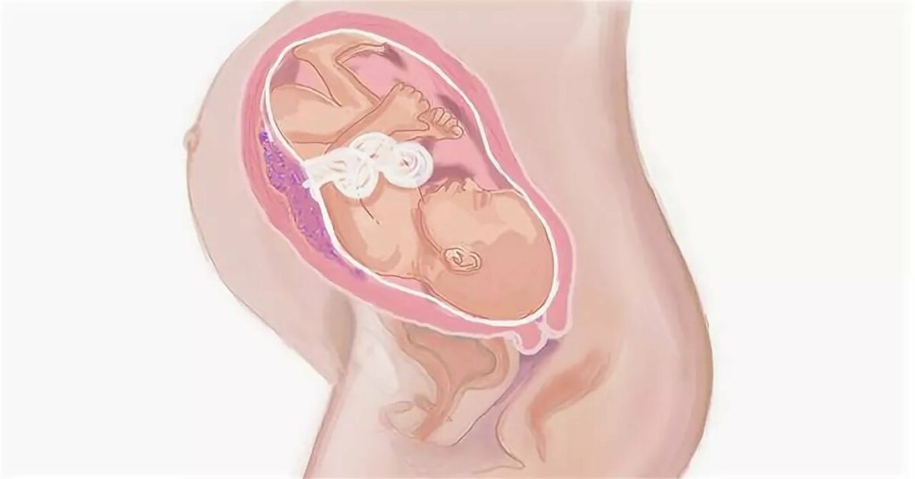 36 недель давит. 34 Неделя беременности акушерские недели. Плод ребенка в 34 недели беременности. Расположение плода на 34 неделе беременности. Матка в 32 недели беременности.