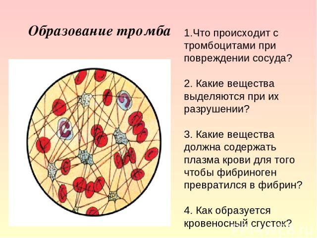 Происходит образование. Образование тромба при кровотечении. При образовании тромба в артерии возникает. Образование тромба при ранении.