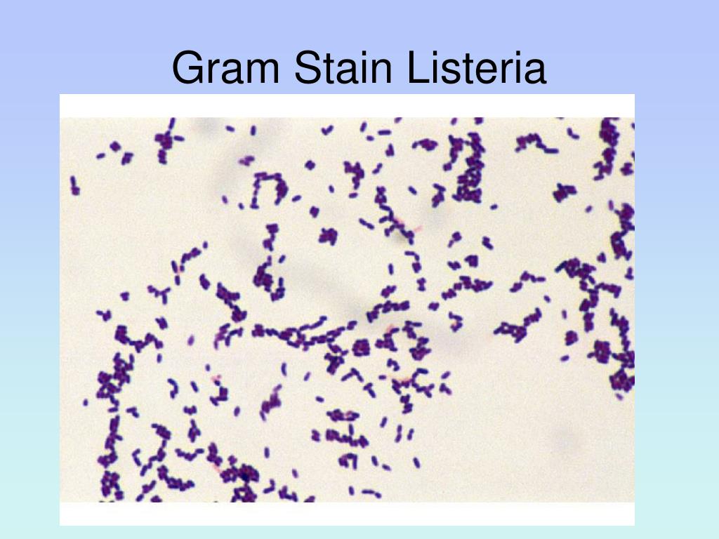 Listeria monocytogenes что это