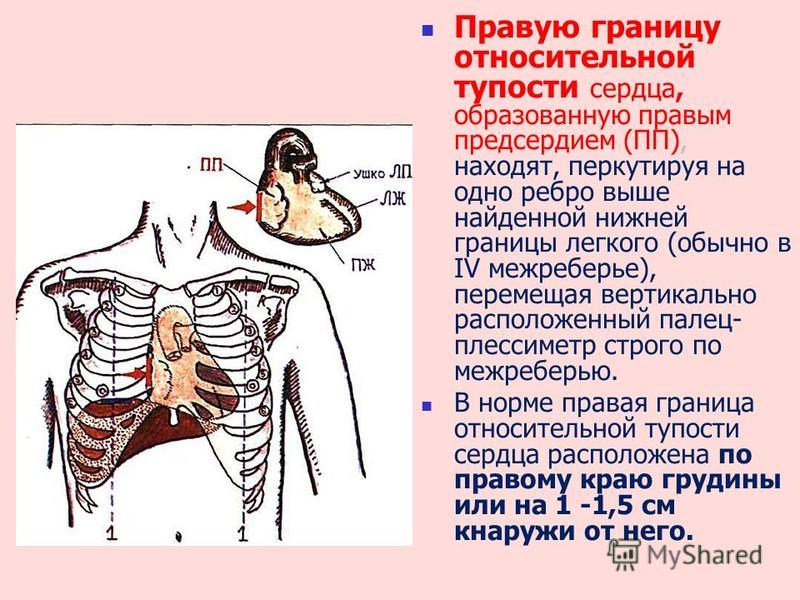 Границы относительной тупости сердца