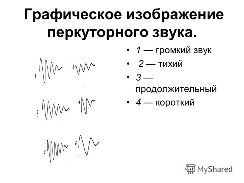 Перкуторно звук