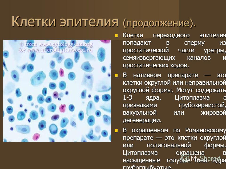 Большое количество клеток. Эпителиальных клеток мазок. Число клеток эпителия в мазке. Клетки промежуточного эпителия. Клетки переходного эпителия в мазке.