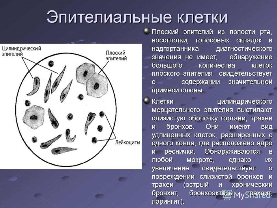 Размеры клеток эпителия. Эпителиальные клетки в мокроте. Клетки плоского эпителия в мокроте. Цитологическое исследование мокроты.