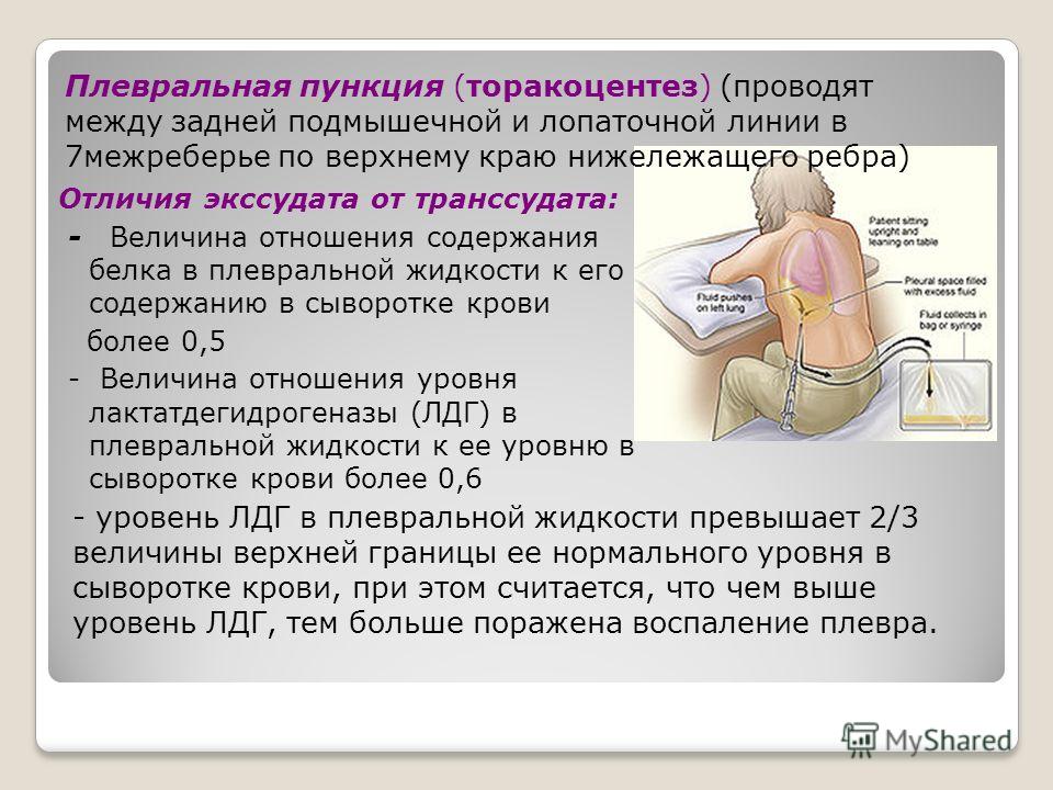 Жидкость в легких причины и лечение. Проведение плевральной пункции. Экссудативный плеврит плевральная пункция. Плевральная пункция проводится при. Плевральная пункция назначается пациентам.