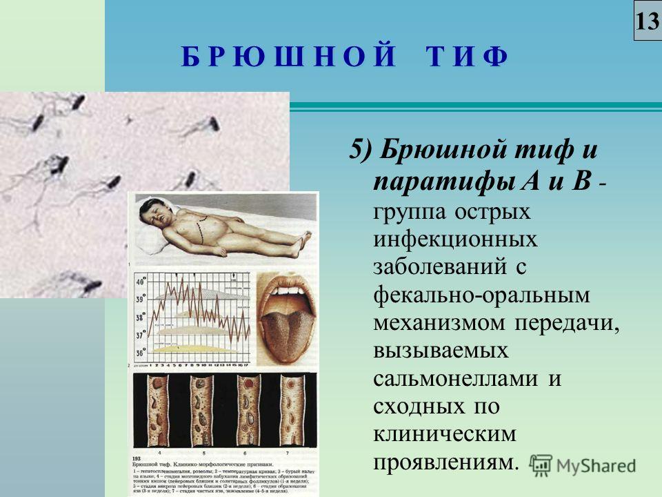 Брюшной тиф это. Брюшной тиф и паратиф. Тиф паратиф брюшной тиф. Брюшной тиф это инфекционное заболевание.