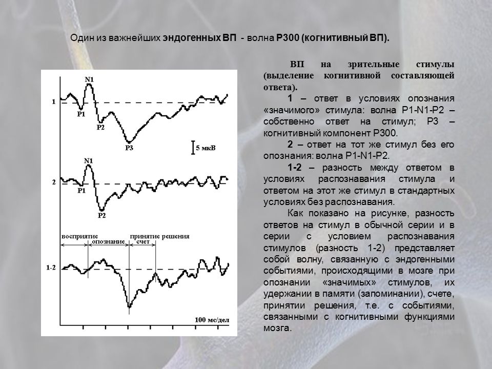 Вызванный исследования. Вызванный потенциал p300 ЭЭГ. Р300 вызванные потенциалы. Когнитивные вызванные потенциалы р300 норма. Когнитивные вызванные потенциалы ЭЭГ.