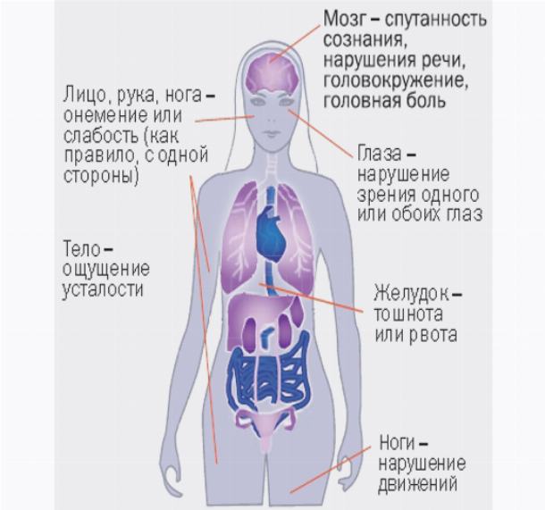 Спутанность сознания