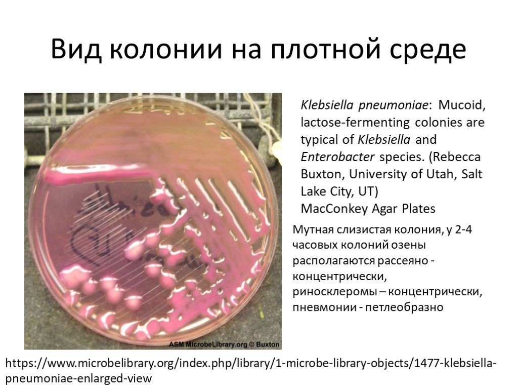 Клебсиелла пневмония. Клебсиеллы питательные среды. Клебсиелла пневмония колонии. Клебсиелла пневмония среда. Рост клебсиелл на питательных средах.