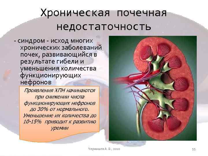 Презентация на тему хроническая почечная недостаточность