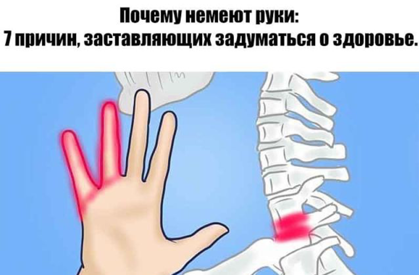 Онемение пальцев после операции. Немеют руки. Немеют пальцы на руках причины.