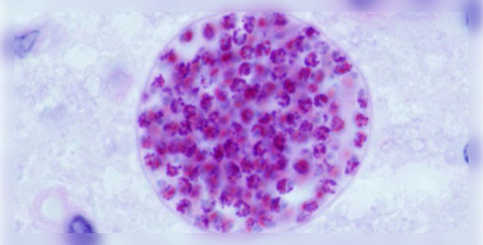 Toxoplasma gondi