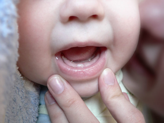 Осмотр первых молочных зубов у ребёнка