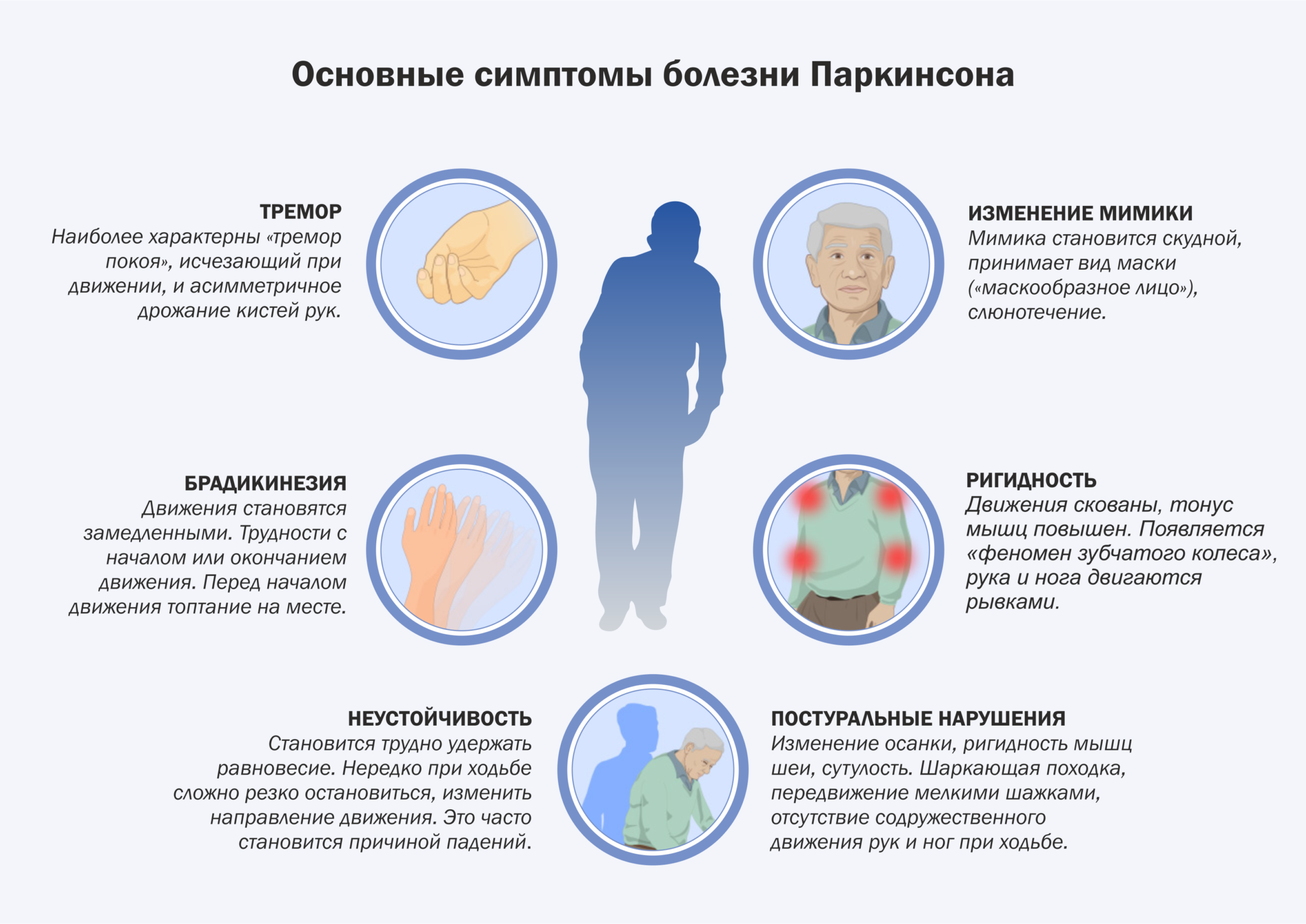 Первый симптомы болезни. Болезнь Паркинсона. Синдром паркинсонизма симптомы. Болезнь Паркинсона симптомы. Клинические проявления паркинсонизма.