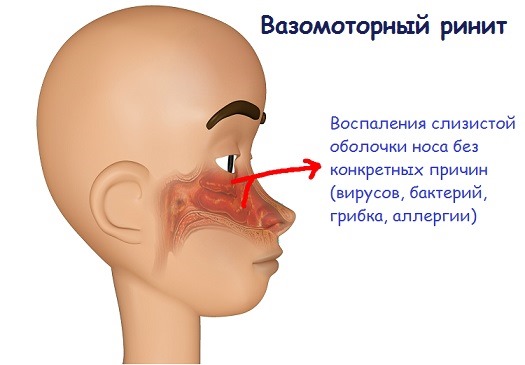 Кварцевание носа и горла в домашних условиях и в больнице: при ангине, беременности, желтухе. Приборы и лампы для кварцевания