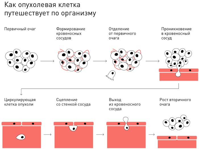 Уплотнение в виде шариков под кожей в паху, под мышкой, на шее, подбородке, щеке, спине. Что это, лечение