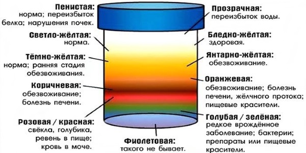 Эритроциты в моче у ребенка. Что это значит, норма, повышенные, неизменные