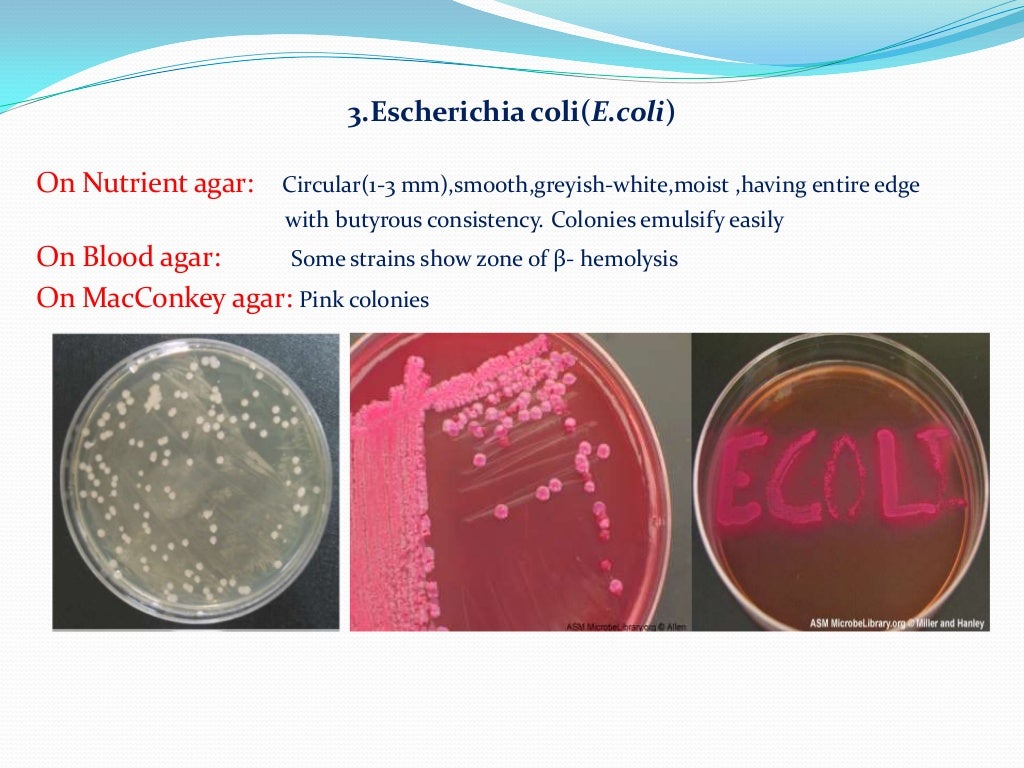 Coli sotwe. Escherichia coli гемолитические антибиотики. Escherichia coli непатогенные. Escherichia coli эшерихии. Эшерихия микробиология.