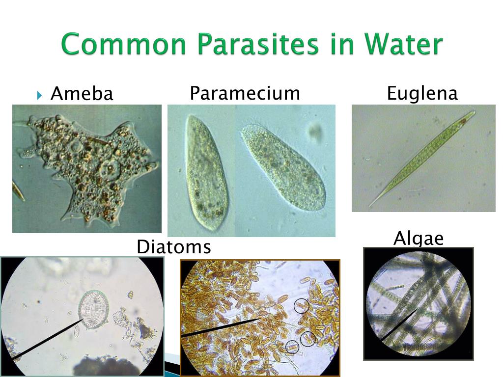 common parasites in water l