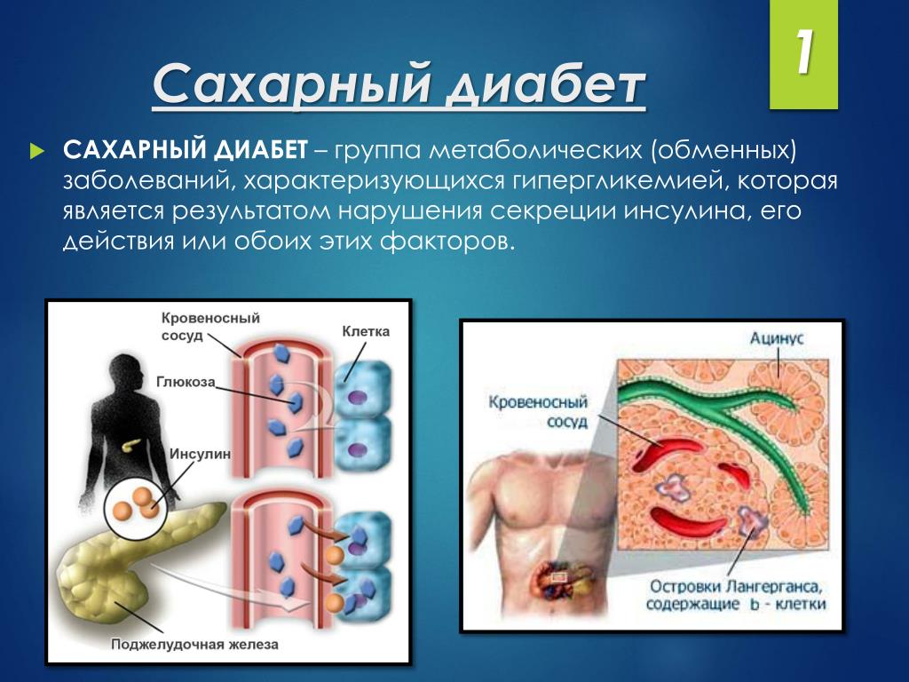 Ханас Диабет 1 Типа Книга Купить