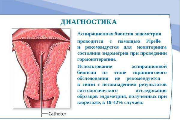 Эндометрия матки лечение. Гиперплазия эндометрия эндометрит. Эндометрий гипоплазия. Гипоплазия эндометрия матки что это. Гиперплазия эндометрия что это такое у женщин.