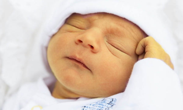 Признаки физиологической желтухи новорожденного