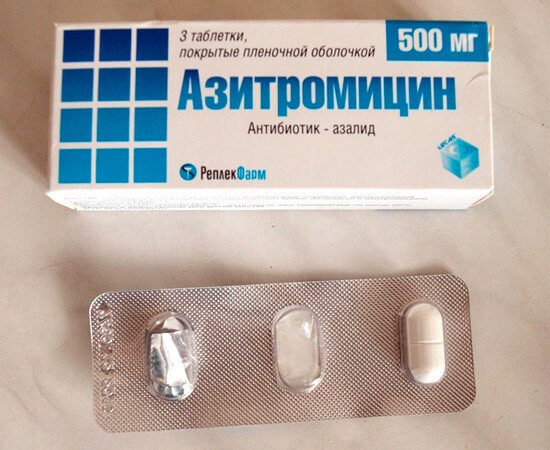 Антибиотик от горла взрослым недорогой