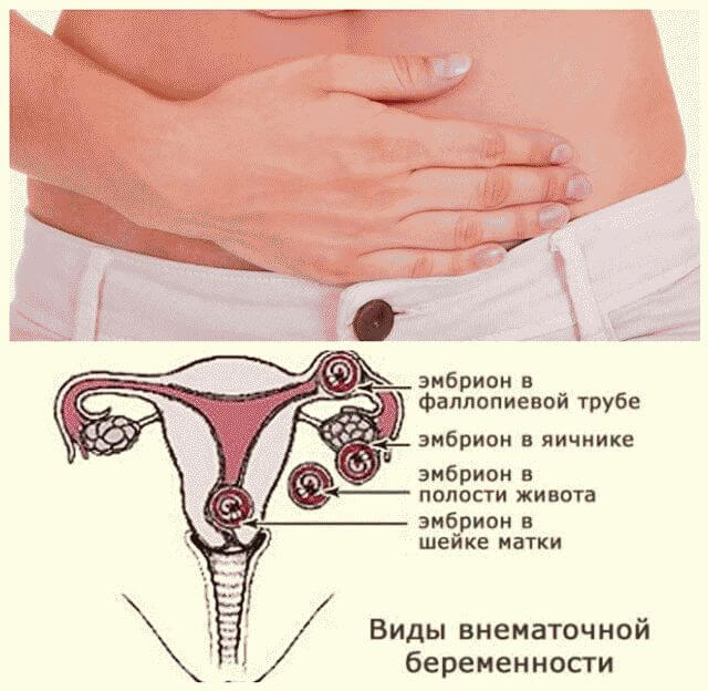 Почему болит низ. Болит низ живота. Женские органы внизу живота. Болит низ живота у женщины. После полового акта болит живот.