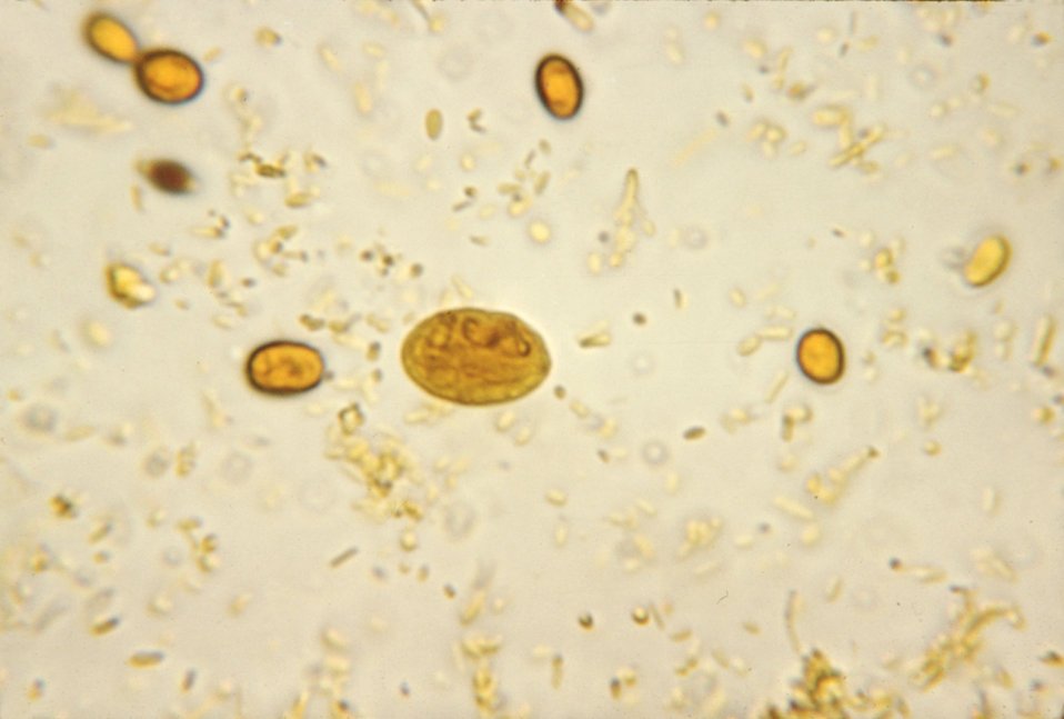 Споры в кале у взрослого. Цисты лямблий микроскопия кала. Микроскопия кала яйца гельминтов.