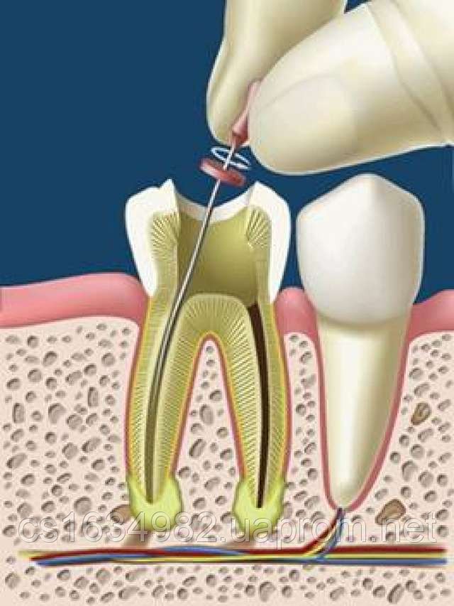 4 канала в зубе