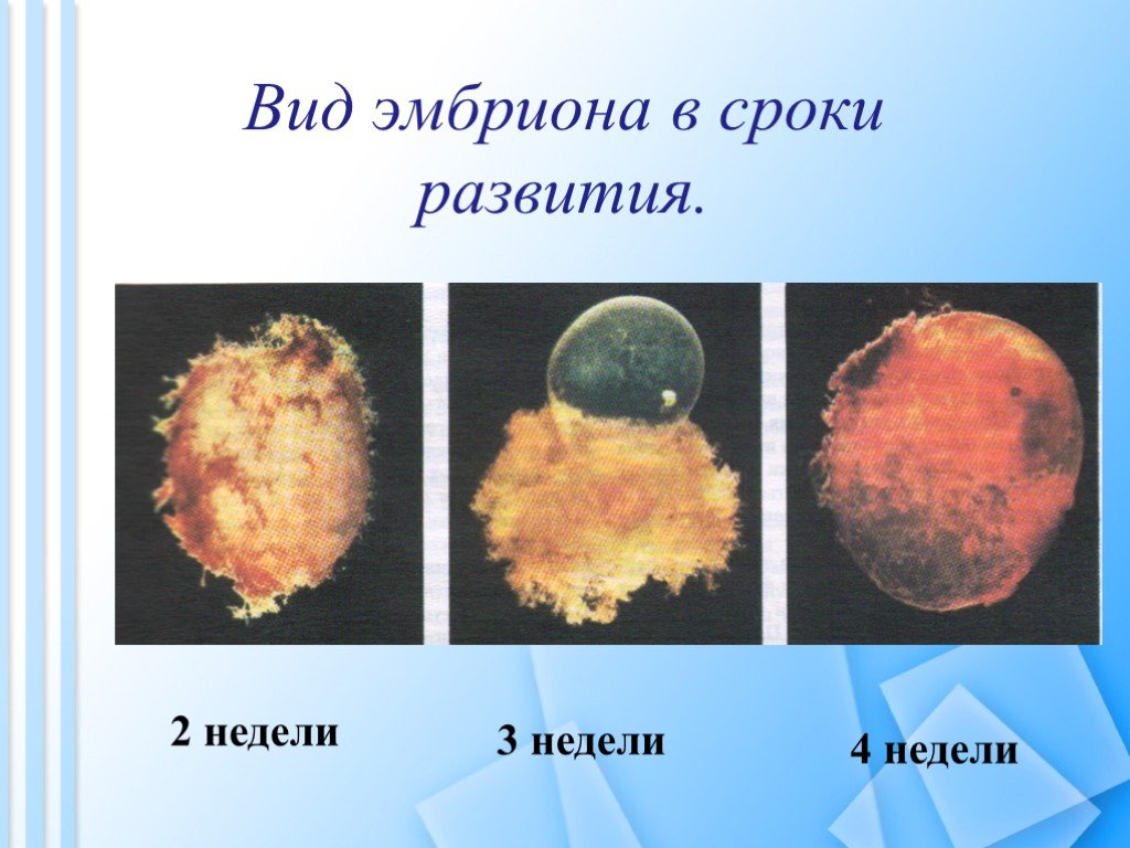 Как выглядит третья. Эмбрион 2-3 недели как выглядит. Как выглядит 2 недельный эмбрион.