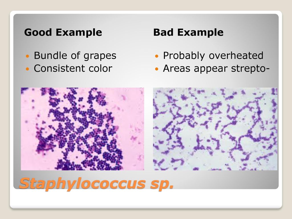 Staphylococcus sp. Good Example Bad Example Bundle of grapes
