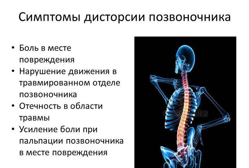 Нарушения отдела позвоночника. Осложнения травм позвоночника грудной отдел. Признаки повреждения грудного отдела позвоночника:. Симптомы дисторсии позвоночника. Дисторсия грудного отдела позвоночника.