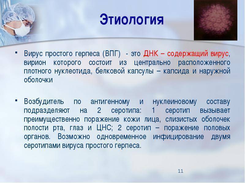 Тест 1 вирусы. Вирусные заболевания герпес. Инфекции вызванные вирусом простого герпеса. Простой герпес этиология.