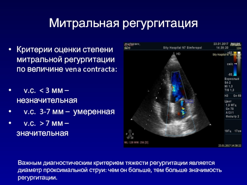 Регургитация 1