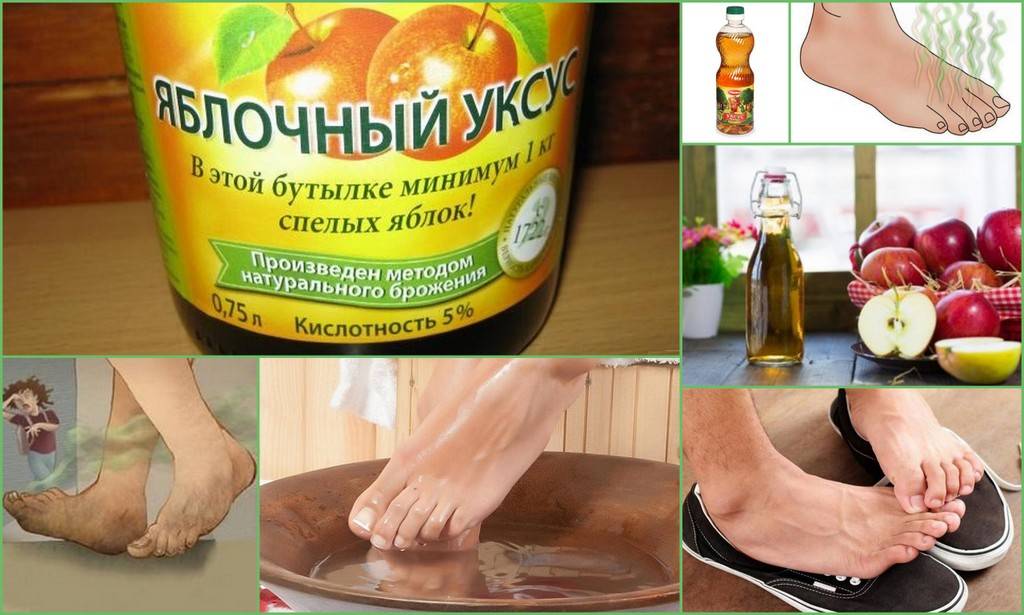 Народные средства от неприятного запаха. Ванночка с яблочным уксусом. Народные средства от потливости ног. Народное средство от потения ног.