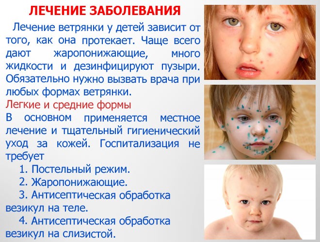 Стрептодермия фото под носом у детей