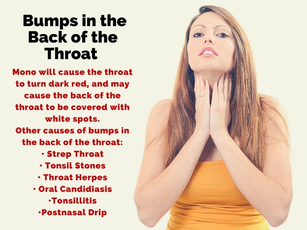 causes of bumps in back of throat
