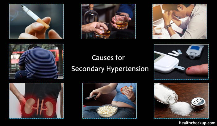 Causes of Secondary Hypertension